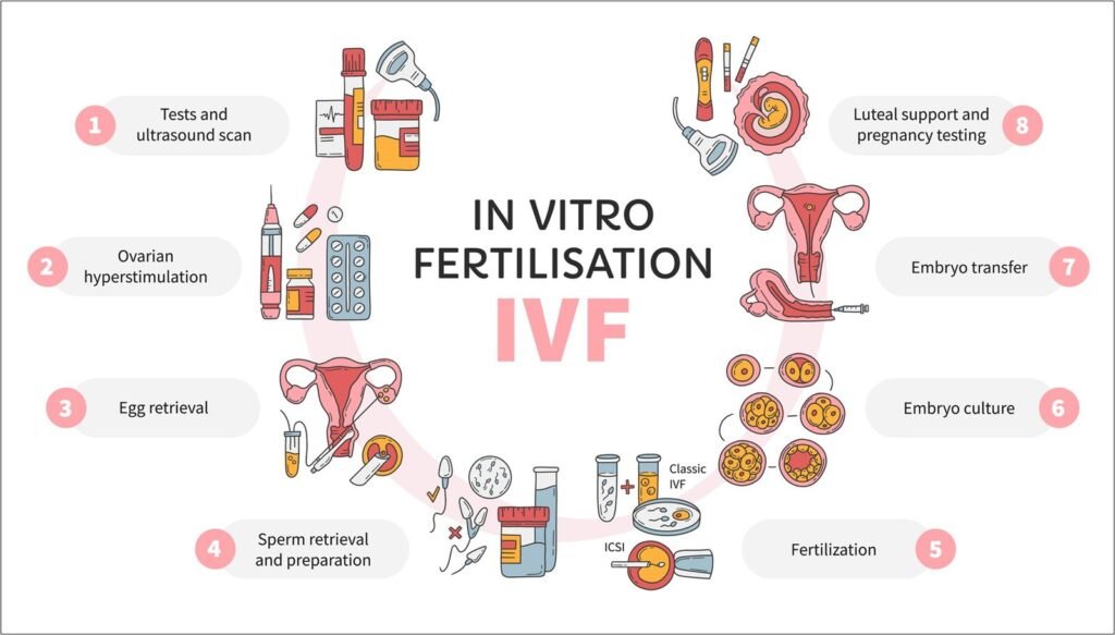 Infografik: die acht Phasen einer IVF – Untersuchungen und Ultraschall, Stimulation der Eierstöcke, Eizellentnahme, Aufbereitung der Spermien, Befruchtung, Kultivierung der Embryonen, Embryotransfer, Lutealphasenunterstützung und Schwangerschaftstest.